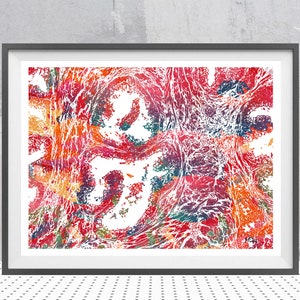Surgery Print Prostate Tissue Anatomy Urology Painting Medical Clinic Decor Healthy Prostate Watercolor Customizable Print Choose Color