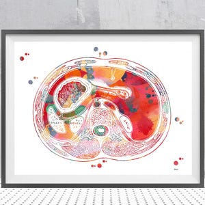 Anatomy Print Abdomen Watercolor Cross Section Of The Human Abdomen Anatomy Art Medical Clinic Wall Art General Surgery GI Illustration
