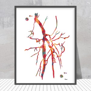 Angiography Print Femoral Spf Artery Occlusion Watercolor Abstract Anatomy Art Angiogram Poster Angiology Print Interventional Radiology