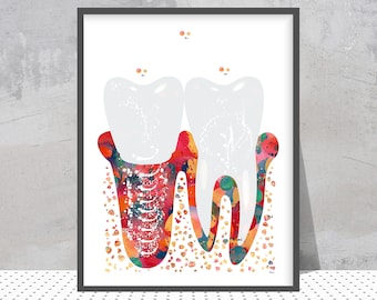 Tooth Implant Watercolor Print - Dentistry Art, Dentist Office Decor