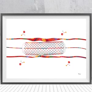 Impresión artística de cirugía cardíaca Arte de anatomía con acuarela Stent Póster de stent coronario Sistema circulatorio Angioplastia con balón Arte clínico de cardiología
