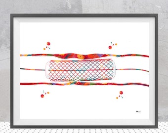 Heart Surgery Print, Coronary Stent Watercolor, Balloon Angioplasty Poster, Cardiology Clinic Art