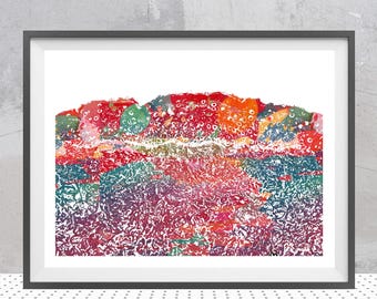 Skin Sun Damage Histology Print | Dermatology Art | Dermatologist Office Decor