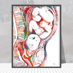 Impresión de acuarela de embarazo, bebé a término en el útero, póster, arte ginecológico, impresión giclée médica, arte anatómico, obstetricia, partería, decoración de pared