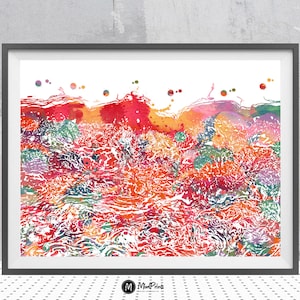Póster de dermatología con anatomía de la dermatitis cutánea. Vista microscópica de la epidermis que muestra la VAC. Dermatitis de la interfaz vacuolar. Arte médico.