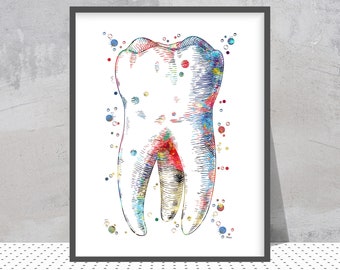 Human Molar Dental Print | Dentist Clinic Decor | Hygienist Gift