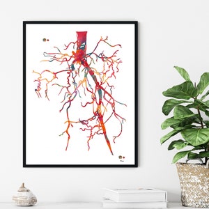 Aorta Angiogram Print Aorta Angiography Watercolor Angiology Painting Abstract Anatomy Print Medical Art Cardiovascular Radiology Print image 3