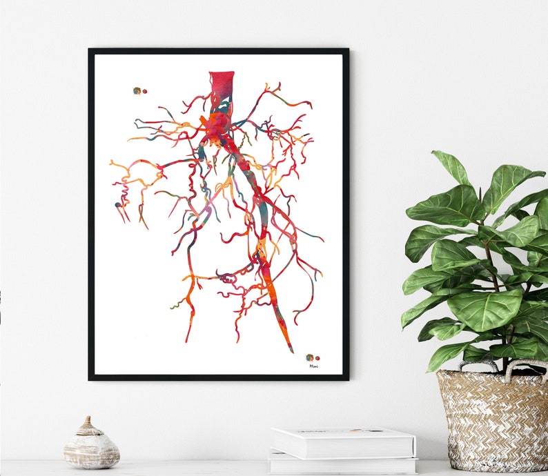 Aorta Angiogram Print Aorta Angiography Watercolor Angiology Painting Abstract Anatomy Print Medical Art Cardiovascular Radiology Print image 3