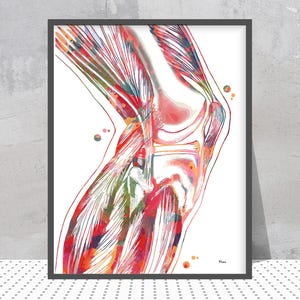 May include: Watercolor print of a knee joint, showcasing the skeletal structure and surrounding muscles. The artwork features a vibrant palette of red, pink, green, and blue hues, with a white background and a black frame. The medical illustration is signed by the artist.