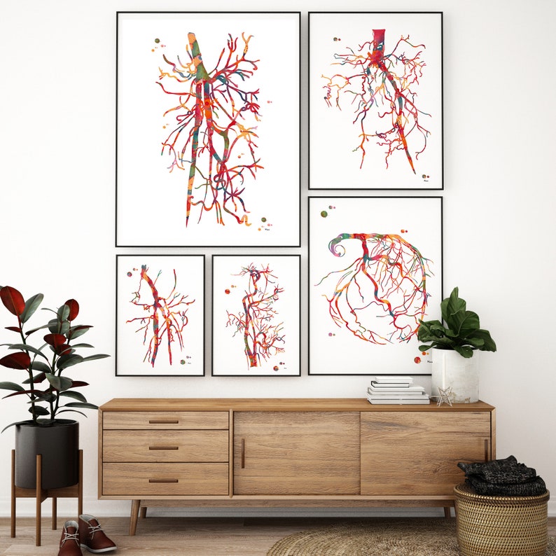 Aorta Angiogram Print Aorta Angiography Watercolor Angiology Painting Abstract Anatomy Print Medical Art Cardiovascular Radiology Print image 8