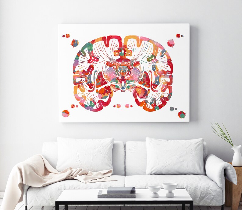 Brain Coronal Section Watercolor Print | Neurology Art | Neurologist ...