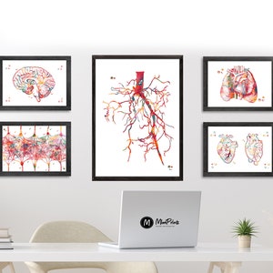 Aorta Angiogram Print Aorta Angiography Watercolor Angiology Painting Abstract Anatomy Print Medical Art Cardiovascular Radiology Print image 4