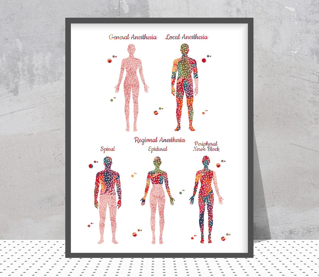 Types of Anesthesia Print Surgery Watercolor General Local Regional ...
