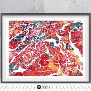 Adenocarcinoma Anatomy Print Human Colon Atypical Carcinoma Histology Watercolor Poster Medical Art Digestive System Medical Clinic Wall Art