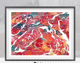 Adenocarcinoma Anatomy Print Human Colon Atypical Carcinoma Histology Watercolor Poster Medical Art Digestive System Medical Clinic Wall Art