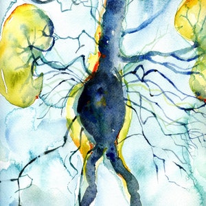 Abdominal Aneurysm Arteriogram Watercolor Print Cardiovascular Painting Blood Vessel Painting Abstract Anatomy Art image 2