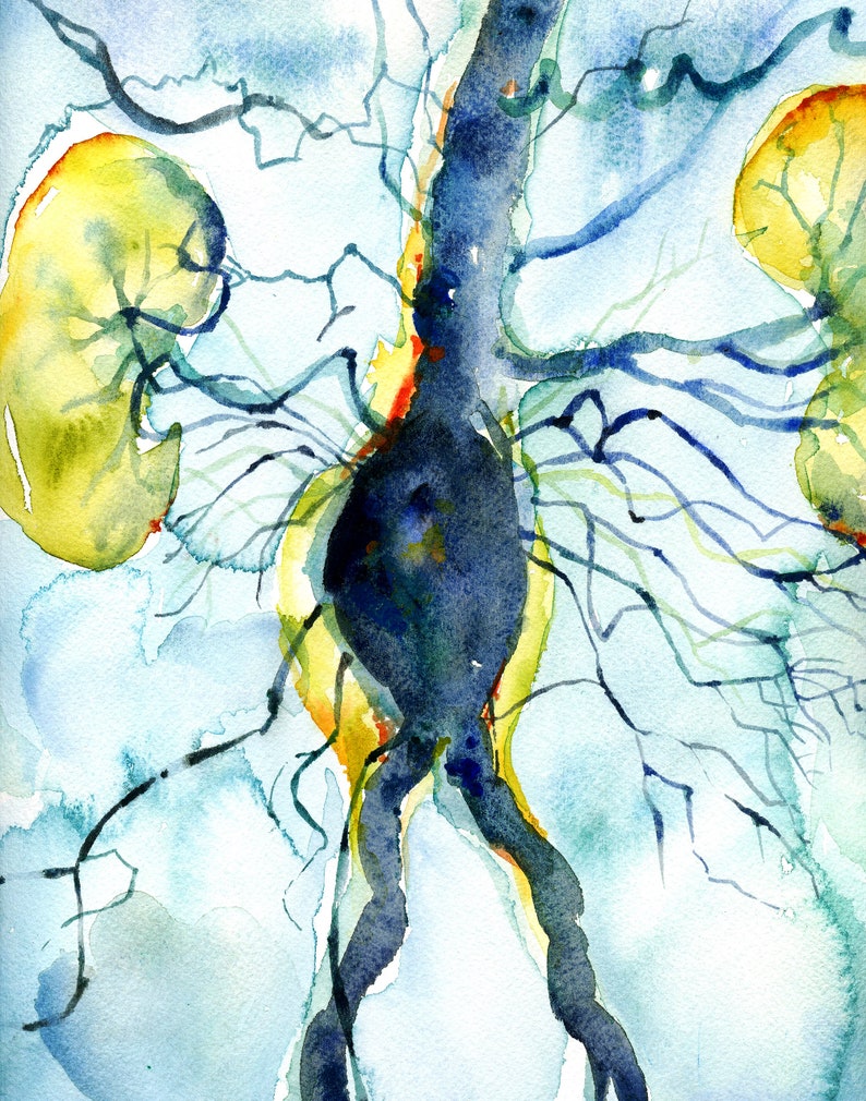 Abdominal Aneurysm Arteriogram Watercolor Print Cardiovascular Painting Blood Vessel Painting Abstract Anatomy Art image 2