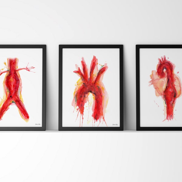 Cardiovascular Watercolor Art Print Set - Abdominal Aneurysm, Aorta and Thoracic Aneurysm Art Set - Anatomy Art Three Print Set