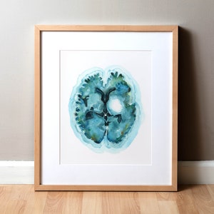 Könnte beinhalten: Ein Aquarellbild eines Gehirnscans mit einem großen weißen Kreis in der Mitte. Das Gehirn ist in Blautönen und Grüntönen gemalt.