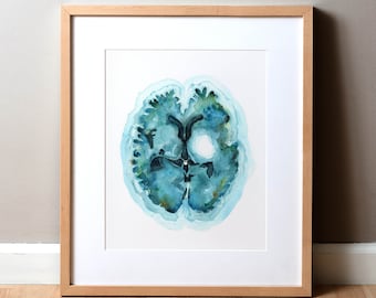 Hemorrhagic Stroke Watercolor Print - Neurology Art - Teal Painting - Anatomy Art Print - Brain Art Print