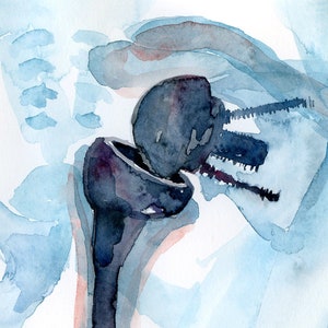 Orthopedics Watercolor Print Orthopedic Surgery Art Medical Art Anatomy Art image 3