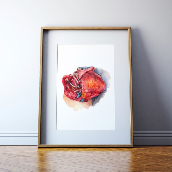 Head and Neck Dissection Watercolor Print - ENT Surgery Art Print