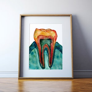 Dent Os Et Gencive Aquarelle Impression Impression Dart Etsy France