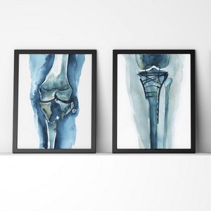Knee Repair Watercolor Print Set - Orthopedics Print - Orthopedic Surgery - Gift for Orthopedic Surgeon