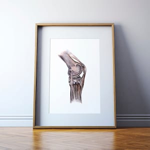May include: A watercolor painting of a human knee joint, showing the bones and ligaments. The painting is in shades of brown and gray, and is set against a white background.