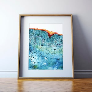 Melanoma in Blue Watercolor Print - Skin Cancer Cell Art - Integumentary System - Epidermis Art - Abstract Anatomy Art