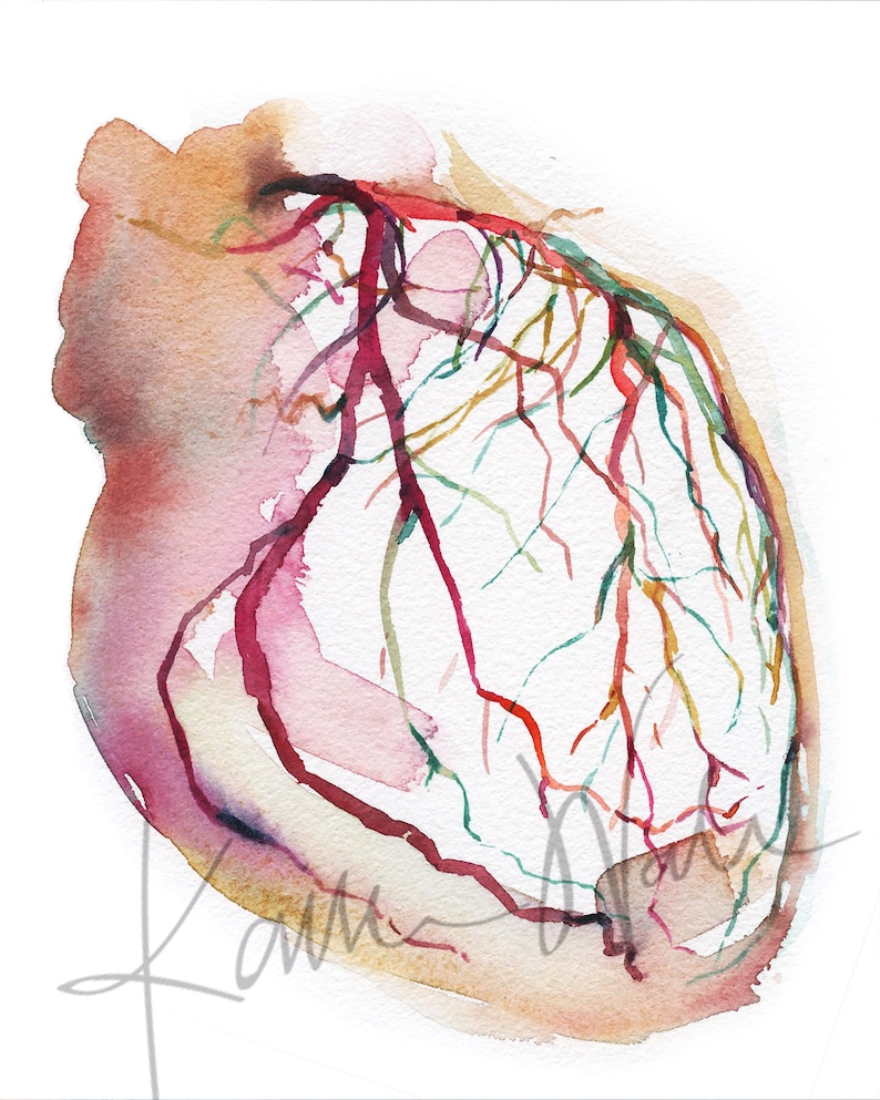 Unframed watercolor painting showing a coronary angiogram x-ray image in reds, purples, greens, oranges and yellows.

heart art, heart painting, coronary angiogram, gift for cardiologist