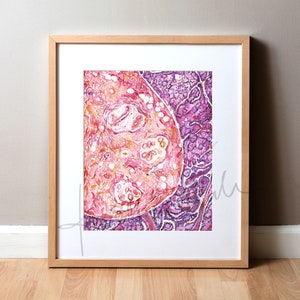 Breast Histology Watercolor Print  - Cancer Art - Histology Art