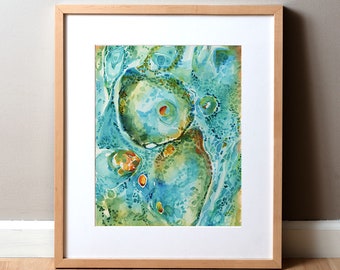 Basal Cell Carcinoma Watercolor Print - Skin Cell Art - Integumentary System - Epidermis Art - Abstract Anatomical Art