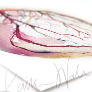 Unframed watercolor painting at an angle showing a coronary angiogram x-ray image in reds, purples, greens, oranges and yellows. 

heart art, heart painting, coronary angiogram, gift for cardiologist