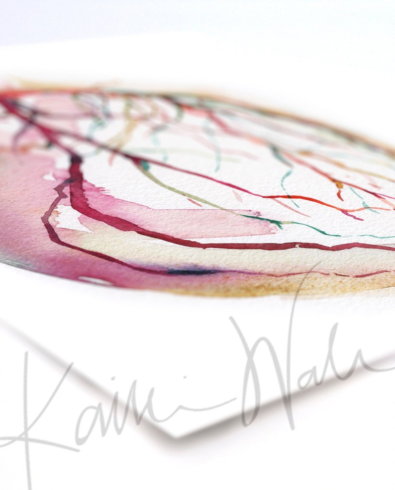 Unframed watercolor painting at an angle showing a coronary angiogram x-ray image in reds, purples, greens, oranges and yellows. 

heart art, heart painting, coronary angiogram, gift for cardiologist