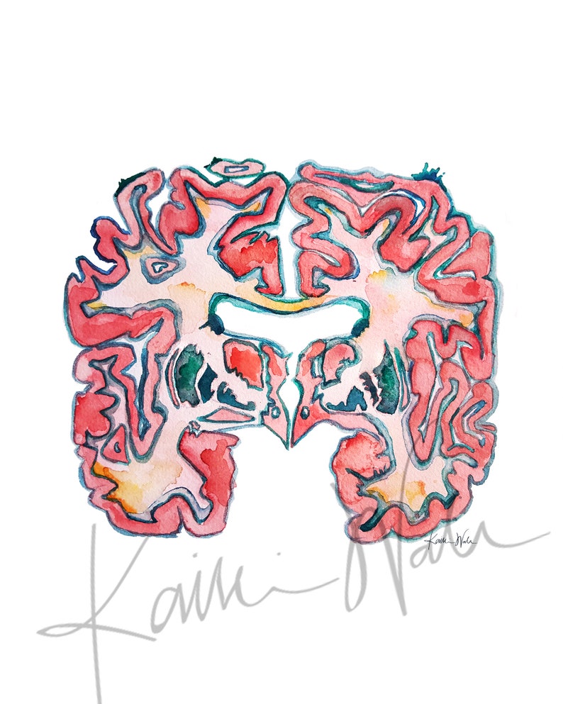 Basal Ganglia Watercolor Print + Commission Fee - Coronal Section of ...