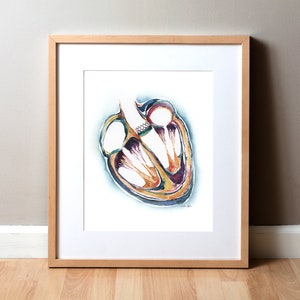 Heart Valve Replacement Watercolor Art Print - Aortic Valve TAVR Edwards Art - Heart Painting - Cardiovascular Art
