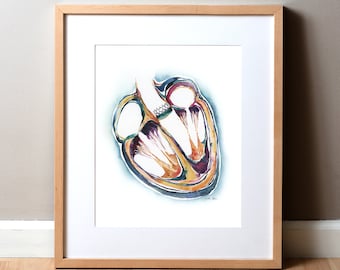 Heart Valve Replacement Watercolor Art Print - Aortic Valve TAVR Edwards Art - Heart Painting - Cardiovascular Art