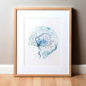 Cerebral Angiography - Brain Art Watercolor - Brain Painting - Neurology and Cardiovascular Art - Anatomy Watercolor Art