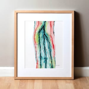 Three Vessel Runoff Watercolor Print - Pulmonology Anatomy Painting