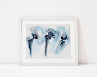 Orthopedics Watercolor Print - Orthopedic Surgery Art - Medical Art - Anatomy Art