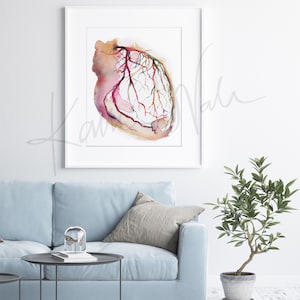 Framed watercolor painting showing a coronary angiogram x-ray image in reds, purples, greens, oranges and yellows. The painting is hanging over a blue couch.

heart art, heart painting, coronary angiogram, gift for cardiologist