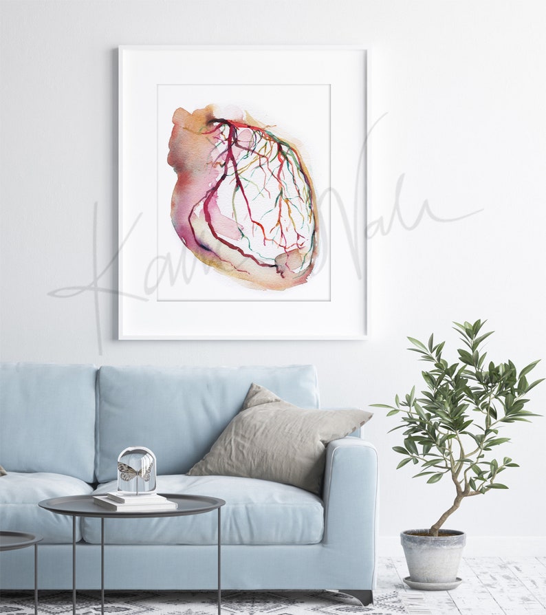 Framed watercolor painting showing a coronary angiogram x-ray image in reds, purples, greens, oranges and yellows. The painting is hanging over a blue couch.

heart art, heart painting, coronary angiogram, gift for cardiologist