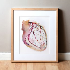 Framed watercolor painting showing a coronary angiogram x-ray image in reds, purples, greens, oranges and yellows.

heart art, heart painting, coronary angiogram, gift for cardiologist