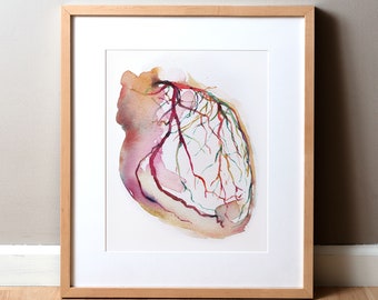 Impresión de acuarela de angiografía coronaria - Pintura de cardiología - Arte del corazón - Regalo de cardiólogo