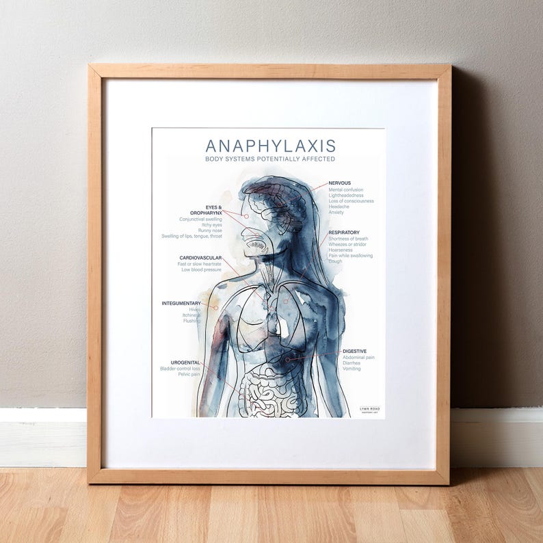 Anaphylaxis Poster Watercolor Art Print Unframed - Allergy Diagram ...