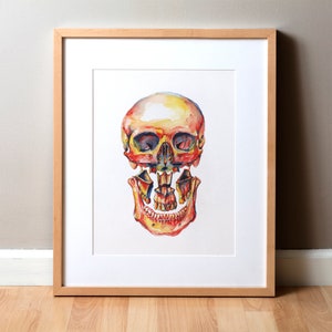 Le Fort I Akwarela Sztuka Wydruku - Chirurgia Szczęki Szczękowej Abstrakcyjna Anatomia Sztuka - Dental OMFS Czaszka Kości Sztuka