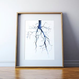 Aorta Angiogram Watercolor Art Print - Cardiovascular Painting - Blood Vessel Painting - Abstract Anatomy Art