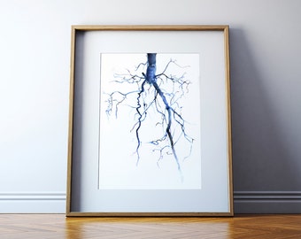 Aorta Angiogram Watercolor Art Print - Cardiovascular Painting - Blood Vessel Painting - Abstract Anatomy Art