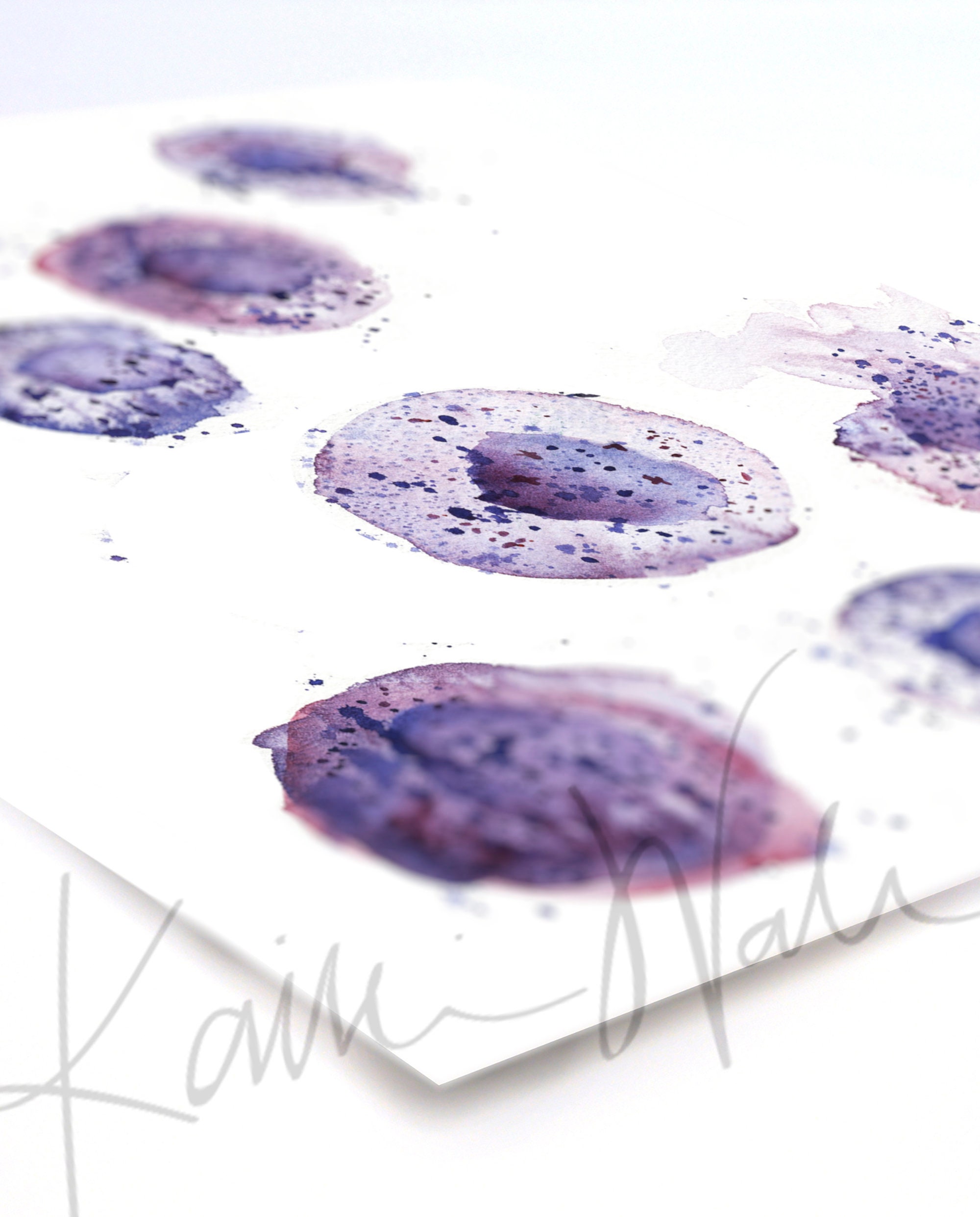 Mast Cell Watercolor Print Unframed - White Blood Cell Watercolor Art ...